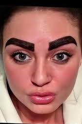 sobrancelha pigmentacao exagerada 2